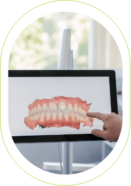 iTero showing smiles on screen